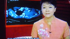 中央电视4台报道YABO鸭脖附属瑞康医院肿瘤科