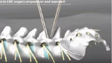 附属国际壮医医院：路窄了不好走，腰椎管窄了那是根本不能走....
