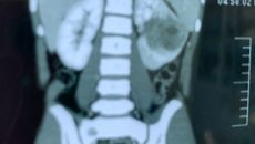 “找到杨体泉教授，就是最好的结果！”