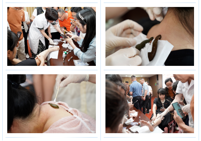 ▲壮医水蛭疗法实操及示范现场